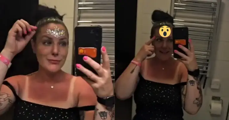 Dame ontdekt DIT op haar voorhoofd na festival: “Je bent Batman!” (video)