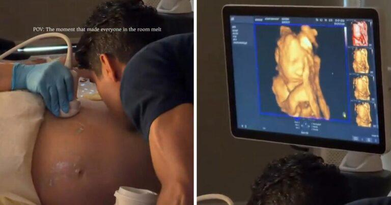 Papa kust zwangere buik, reactie van baby op 4D-echo doet harten smelten (video)